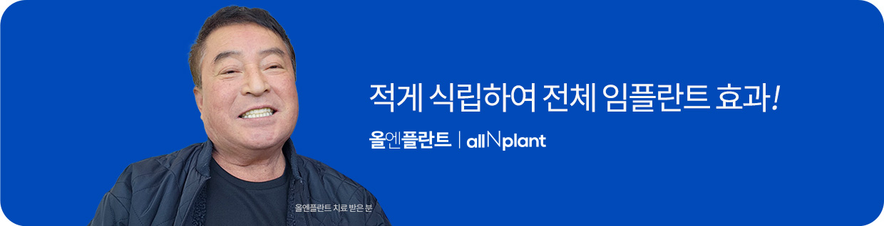 적게 식립하여 전체 임플란트 효과!