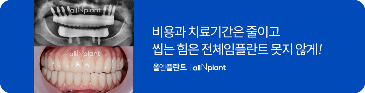 비용과 치료기간은 줄이고 씹는 힘은 전체임플란트 못지 않게!