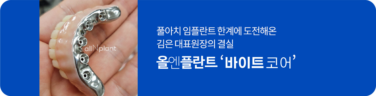 풀아치 임플란트 한계에 도전해온 김은 대표원장의 결실 올엔플란트 ‘바이트코어’