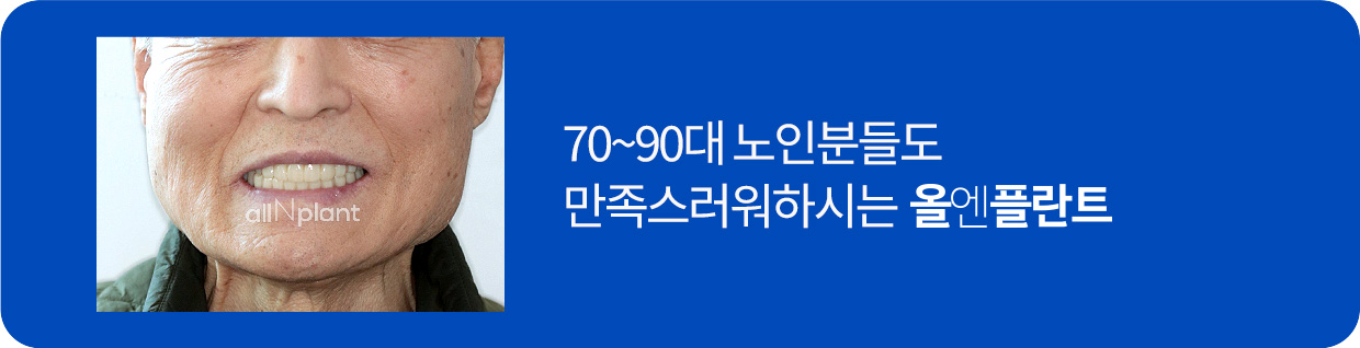 70~90대 노인분들도 만족스러워하시는 올엔플란트
