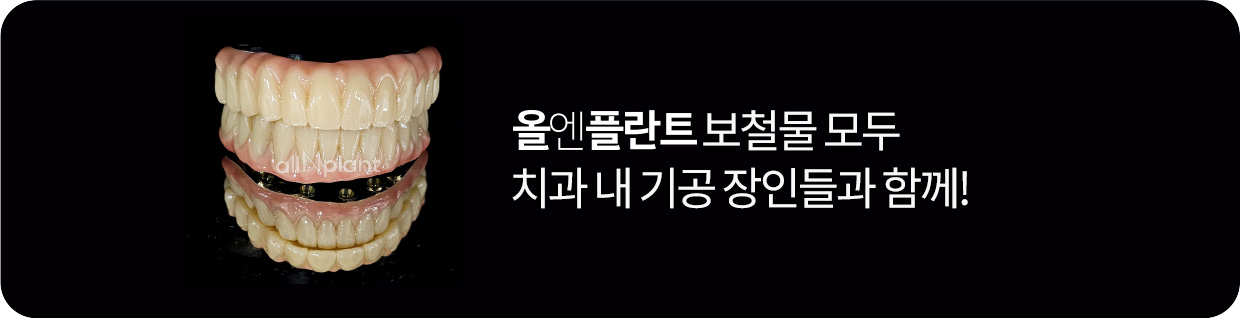 올엔플란트 보철물 모두 치과 내 기공 장인들과 함께!