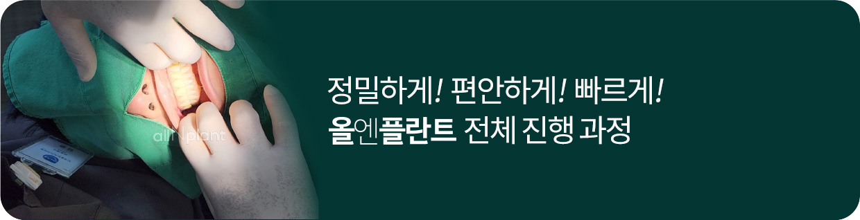 정밀하게! 편안하게! 빠르게! 올엔플란트 전체 진행 과정