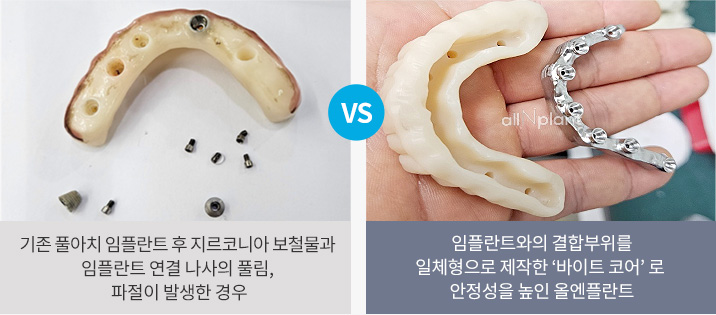 기존 풀아치 임플란트 후 지르코니아 보철물과 임플란트 연결 나사의 풀림, 파절이 발생한 경우 VS 임플란트와의 결합부위를 일체형으로 제작한 ‘바이트 코어’ 로 안정성을 높인 올엔플란트