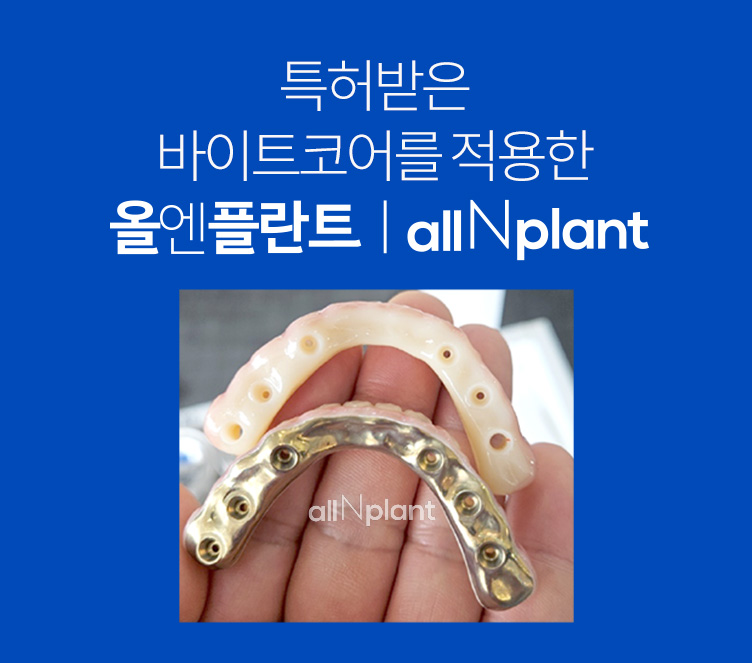 특허받은 바이트코어를 적용한