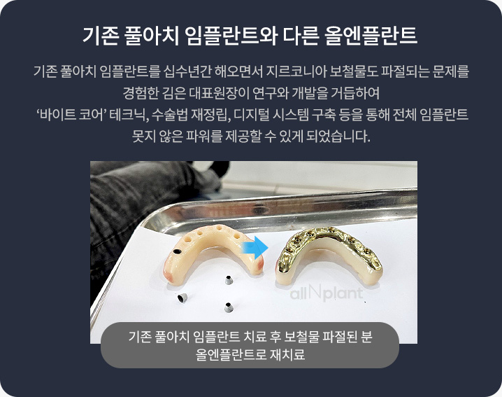 기존 풀아치 임플란트와 다른 올엔플란트. 기존 풀아치 임플란트를 십수년간 해오면서 지르코니아 보철물도 파절되는 문제를 경험한 김은 대표원장이 연구와 개발을 거듭하여 ‘바이트 코어’ 테크닉, 수술법 재정립, 디지털 시스템 구축 등을 통해 전체 임플란트 못지 않은 파워를 제공할 수 있게 되었습니다.