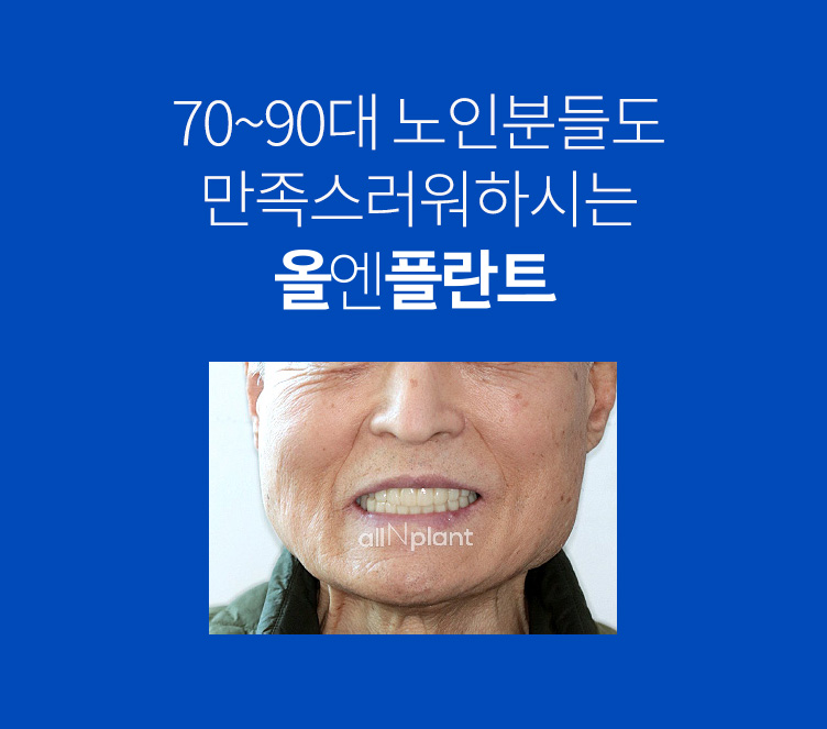 70~90대 노인분들도 만족스러워하시는 올엔플란트