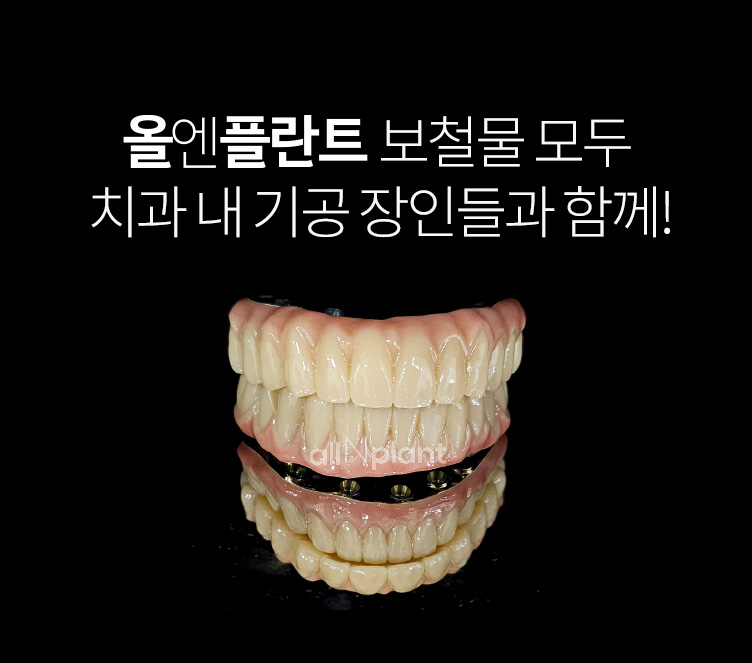 올엔플란트 보철물 모두 치과 내 기공 장인들과 함께!