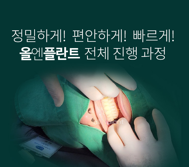 정밀하게! 편안하게! 빠르게! 올엔플란트 전체 진행 과정